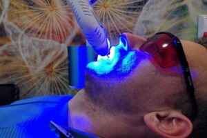 branqueamento dentes algarve branqueamento dentes algarve