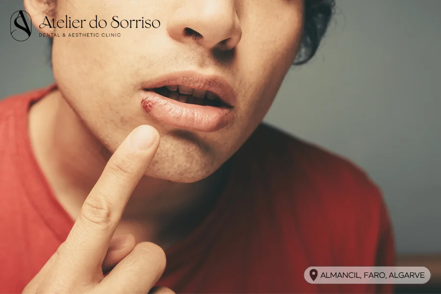 herpes labial algarve faro almancil