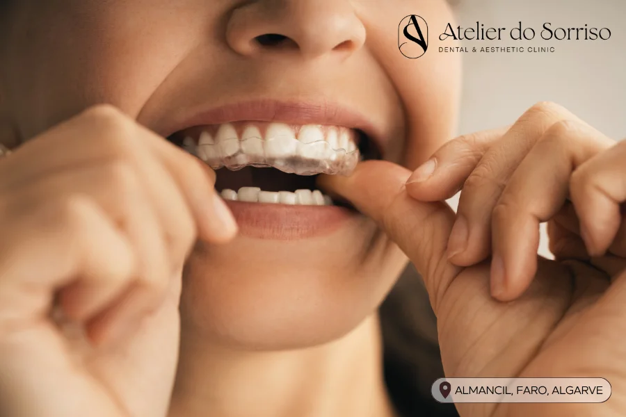 dentista invisalign algarve faro almancil dentista invisalign algarve faro almancil
