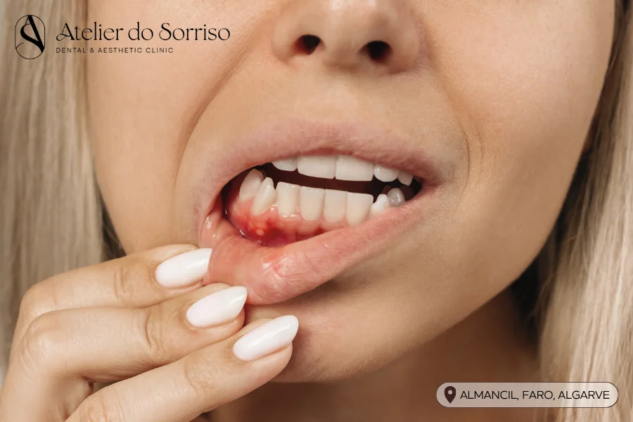 abcesso dentario gengival algarve faro almancil
