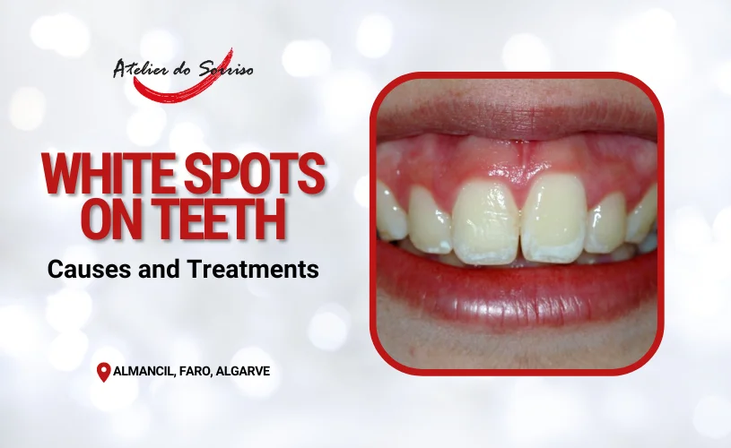 dentist white spots teeth treatments