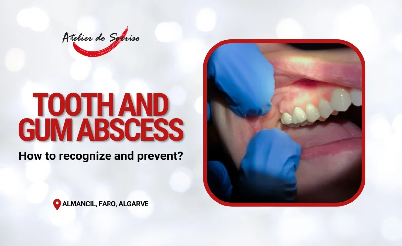 tooth abscess gum abscess causes treatments
