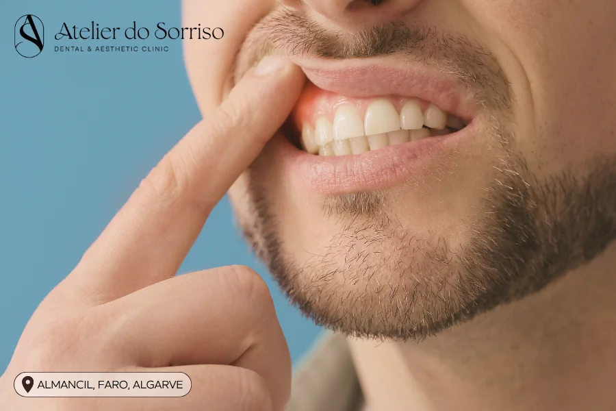 tratamento dor gengiva algarve faro almancil tratamento dor gengiva algarve faro almancil