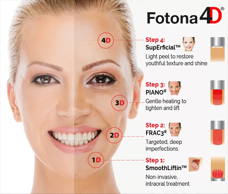 laser fotona D etapes algarve faro almancil