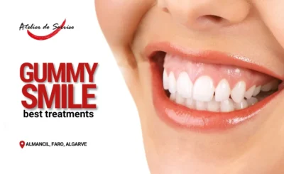 gummy smile treatments algarve faro almancil gummy smile treatments algarve faro almancil